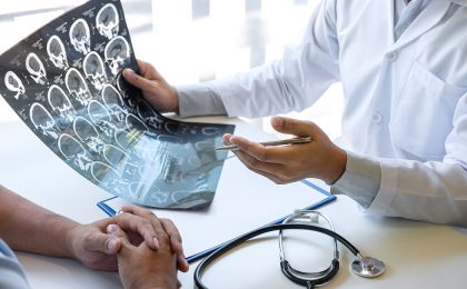 Alzheimer: Statul român își condamnă vârstnicii „la uitare”: „Primesc ajutor în stadii avansate ale bolii” 2 Dementa pacient